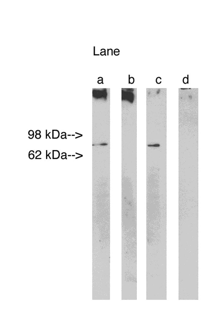 Western blot analysis using Lass 1 (Cat. # X2311P) at 5ug/ml on Human Brain lysate 14 ug/lane (Cat. # X1633C).  Lane A] antibody alone, Lane B] antibody with 45ug peptide, Lane C] antibody with nonspecific peptide, D]conjugate alone. Visualized using Pierce West Femto substrate system.  Anti Rabbit secondary used at 1:3.5K dilution (Cat. # X1207M). Exposure for 5 minutes